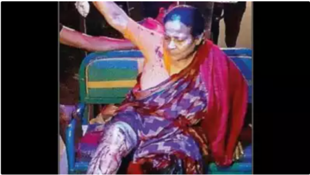 BJP Woman Candidate Krishna Bhattacharya (59) Badly Beaten Up By TMC Goons: Kolkata, WB